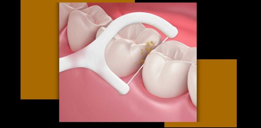 Dental Checkup Room – Smile Cure Clinic